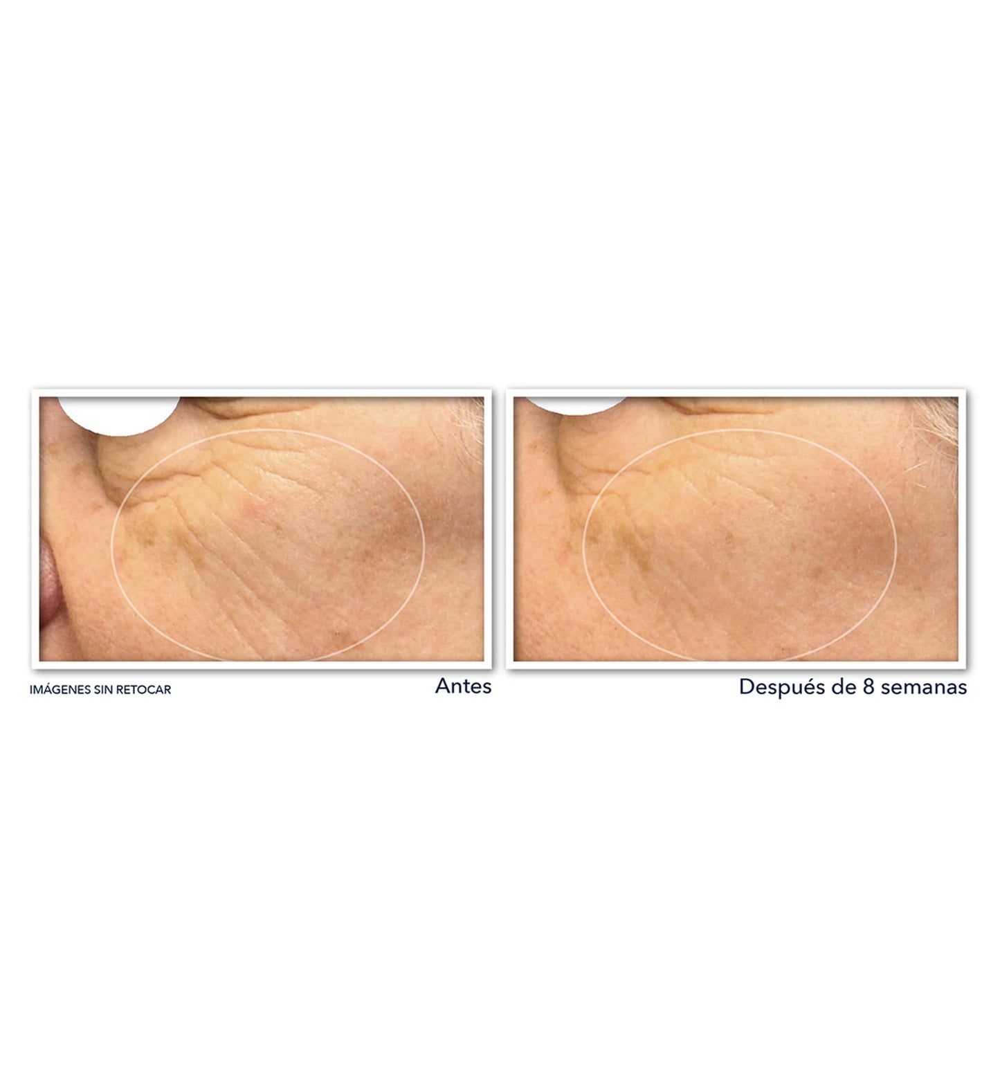 RoC - Multi Correxion Revive + Glow Suero de Noche con Vitamina C - Antiarrugas y Envejecimiento - Reducción de Puntos Negros - Cápsulas de 30 piezas