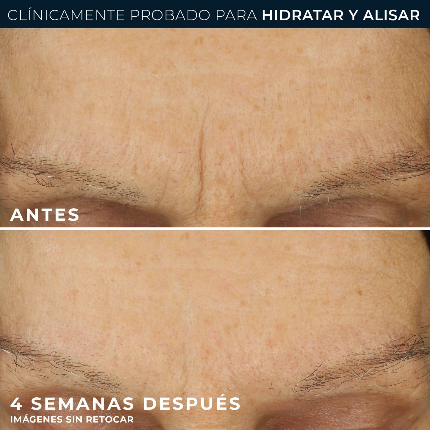 RoC - Retinol Correxion Line Suavizante Max Hidratación Diaria - Hidratante Facial Intensivo Antiarrugas y Antienvejecimiento - con Ácido Hialurónico - 50 ml