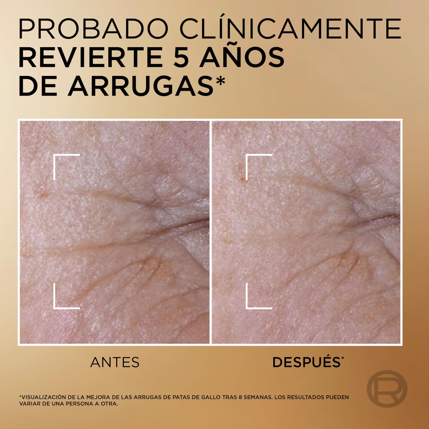 L’Oréal Paris, Age Perfect Serum Le Duo Rejuvenecedor, Antiarrugas, Efecto Reafirmante y Antiedad, con Péptidos de Colágeno, Vitaminas B3 y C*, Piel más suave y luminosa, para tipo de pieles, 30 ml