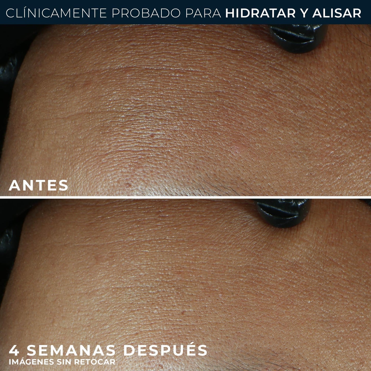 RoC - Retinol Correxion Line Suavizante Max Hidratación Diaria - Hidratante Facial Intensivo Antiarrugas y Antienvejecimiento - con Ácido Hialurónico - 50 ml